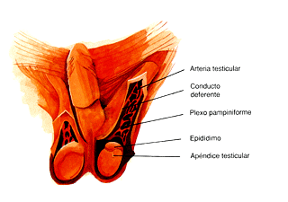 Varicocele
