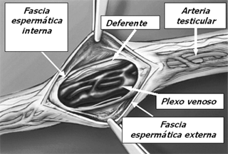 Visión del cordón inguinal con sus múltiples estructuras