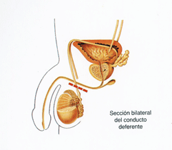 Esquema aparato reproductor masculino