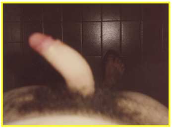 ¿Qué debo hacer si noto incurvación o un bulto en el pene?