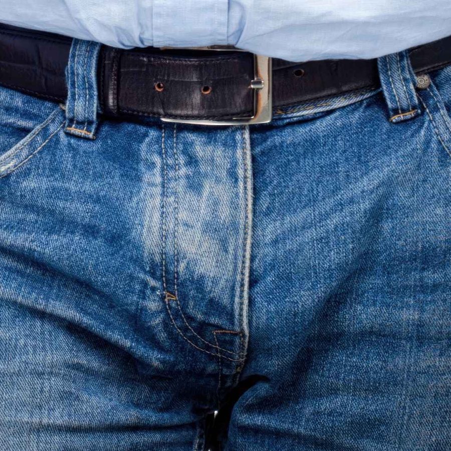 ¿Cuáles son los tipos de fimosis y cómo identificarlos?