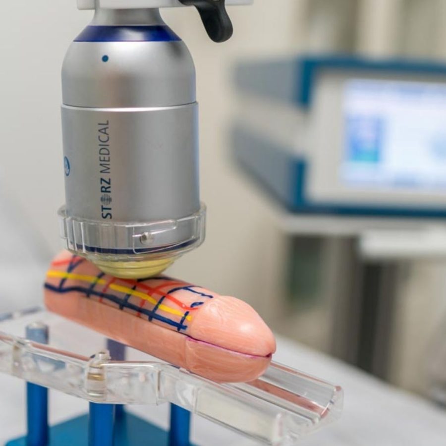 ¿Qué efectos tienen las ondas de choque en pacientes con disfunción eréctil?